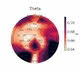 EEG image